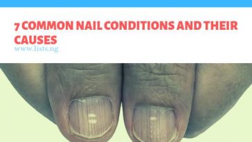 7 common nail conditions and their causes – Lists.ng